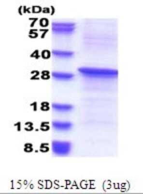 SDS-Page: REV1 Recombinant Protein [NBP2-51681] - 15% SDS Page (3 ug)