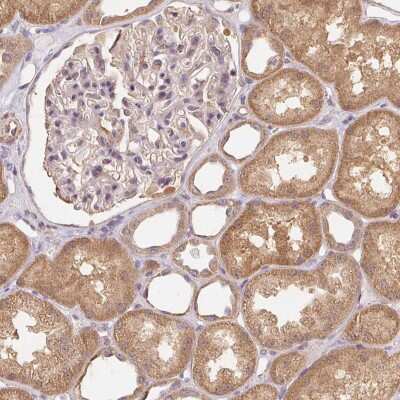 Immunohistochemistry: REV3L Antibody [NBP2-39036] - Staining of human kidney shows moderate cytoplasmic positivity in cells in kidney tubules.