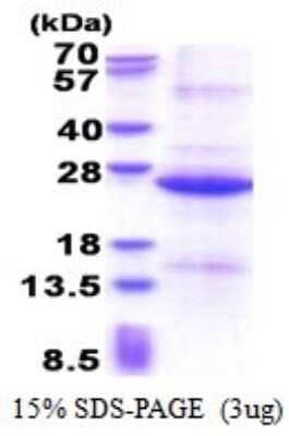 SDS-Page: REXO1 Recombinant Protein [NBP2-51560] - 15% SDS Page (3 ug)