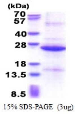 SDS-PAGE Recombinant Human REXO1 His Protein