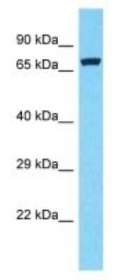 Western Blot: REXO1L1 Antibody [NBP3-09886] - Western blot analysis of REXO1L1 in RPMI-8226 Whole Cell lysates. Antibody dilution at 1.0ug/ml