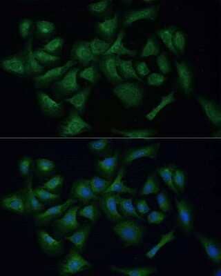 Immunocytochemistry/Immunofluorescence: REXO2 Antibody [NBP2-93904] - Analysis of U-2 OS cells using REXO2 . Blue: DAPI for nuclear staining.