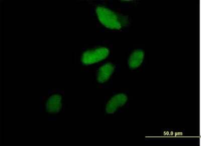 Immunocytochemistry/Immunofluorescence: RFC2 Antibody [H00005982-B01P] - Analysis of purified antibody to RFC2 on HeLa cell. (antibody concentration 10 ug/ml)