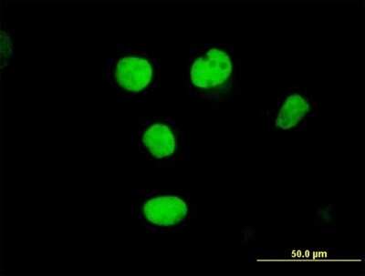 Immunocytochemistry/Immunofluorescence: RFC2 Antibody [H00005982-B02P] - Analysis of purified antibody to RFC2 on HeLa cell. (antibody concentration 10 ug/ml)