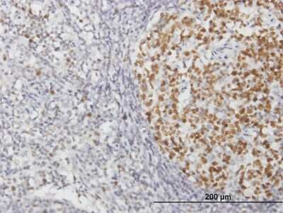 Immunohistochemistry-Paraffin: RFC2 Antibody [H00005982-B02P] - Analysis of purified antibody to RFC2 on formalin-fixed paraffin-embedded human lymph node. (antibody concentration 3 ug/ml)