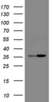 Western Blot: RFC2 Antibody (OTI11C6) - Azide and BSA Free [NBP2-73856] - Analysis of HEK293T cells were transfected with the pCMV6-ENTRY control (Left lane) or pCMV6-ENTRY RFC2.