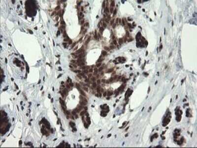 Immunohistochemistry: RFC2 Antibody (OTI2B2) - Azide and BSA Free [NBP2-73857] - Analysis of Human breast tissue.