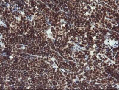 Immunohistochemistry: RFC2 Antibody (OTI2B2) - Azide and BSA Free [NBP2-73857] - Analysis of Human lymphoma tissue.