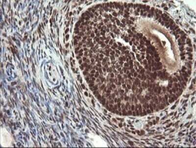 Immunohistochemistry: RFC2 Antibody (OTI2B2) - Azide and BSA Free [NBP2-73857] - Analysis of Human Ovary tissue.