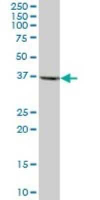 Western Blot: RFC2 Antibody [H00005982-B01P] - Analysis of RFC2 expression in human pancreas.