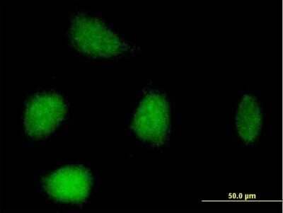 Immunocytochemistry/Immunofluorescence: RFC3 Antibody [H00005983-B02P] - Analysis of purified antibody to RFC3 on HeLa cell. (antibody concentration 10 ug/ml)