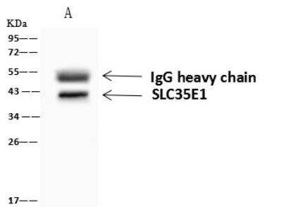 Immunoprecipitation: RFC3 Antibody [NBP2-97788] - Lane A:0.5 mg Jurkat Whole Cell Lysate4 uL anti-RFC3 rabbit polyclonal antibody and 60 ug of Immunomagnetic beads Protein A/G.Primary antibody:Anti-RFC3 rabbit polyclonal antibody,at 1:100 dilution Secondary antibody:Goat Anti-Rabbit IgG (H+L)/HRP at 1/10000 dilutionDeveloped using the ECL technique.Performed under reducing conditions.Predicted band size: 41 kDaObserved band size :41 kDa