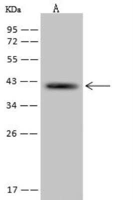 Western Blot: RFC3 Antibody [NBP2-97788] - Lane A: Jurkat Whole Cell LysateLysates/proteins at 30 ug per lane.SecondaryGoat Anti-Rabbit IgG (H+L)/HRP at 1/10000 dilution.Developed using the ECL technique.Performed under reducing conditions.Predicted band size:41 kDaObserved band size:41 kDa