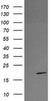 Western Blot: RFESD Antibody (OTI2A7) - Azide and BSA Free [NBP2-73860] - Analysis of HEK293T cells were transfected with the pCMV6-ENTRY control (Left lane) or pCMV6-ENTRY RFESD.