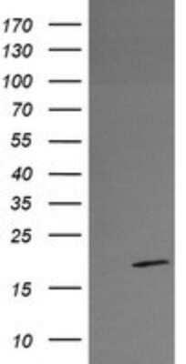 Western Blot: RFESD Antibody (OTI2A7) [NBP2-45947] - Analysis of HEK293T cells were transfected with the pCMV6-ENTRY control (Left lane) or pCMV6-ENTRY RFESD.