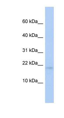Western Blot: RFESD Antibody [NBP1-56910] - Human Brain lysate, concentration 0.2-1 ug/ml.