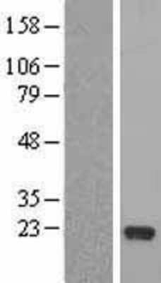 Western Blot: RFESD Overexpression Lysate (Adult Normal) [NBL1-15296] Left-Empty vector transfected control cell lysate (HEK293 cell lysate); Right -Over-expression Lysate for RFESD.