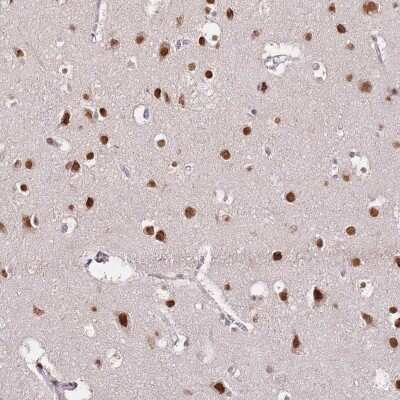 Immunohistochemistry RFK Antibody