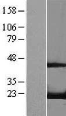 Western Blot RFK Overexpression Lysate