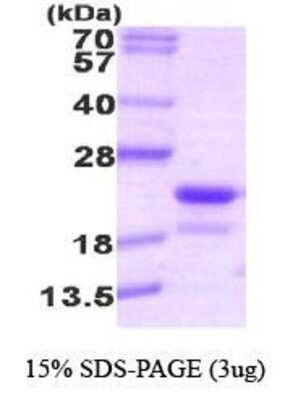 SDS-PAGE Recombinant Human RFK His Protein