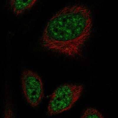 Immunocytochemistry/Immunofluorescence: RFPL2 Antibody [NBP2-57626] - Staining of human cell line SiHa shows localization to nuclear speckles. Antibody staining is shown in green.