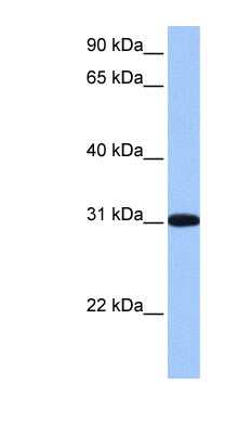 Western Blot: RFPL2 Antibody [NBP1-56360] - Human Liver cell lysate, concentration 0.2-1 ug/ml.