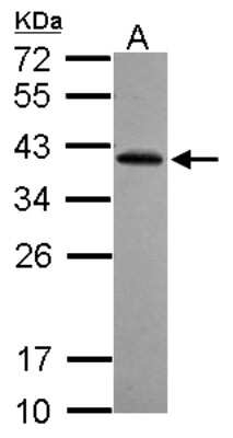 Western Blot: RFPL2 Antibody [NBP2-20138] - Sample (30 ug of whole cell lysate) A: NT2D1 12% SDS PAGE gel, diluted at 1:1000.