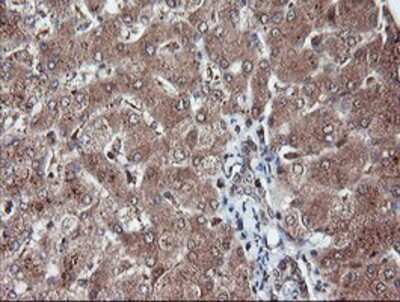 Immunohistochemistry-Paraffin: RFPL3 Antibody (2G4) [NBP2-02034] - Staining of paraffin-embedded Human liver tissue using anti-RFPL3 mouse monoclonal antibody.
