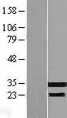 Western Blot RFPL3 Overexpression Lysate