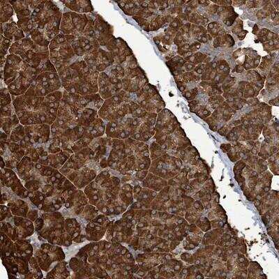 Immunohistochemistry-Paraffin: RFPL4A Antibody [NBP2-13222] - Staining of human pancreas shows strong cytoplasmic positivity in exocrine glandular cells.