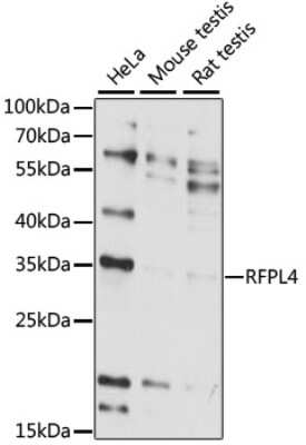 Western Blot: RFPL4A Antibody [NBP2-93598] - Analysis of extracts of various cell lines, using RFPL4A at 1:1000 dilution. Secondary antibody: HRP Goat Anti-Rabbit IgG (H+L) at 1:10000 dilution. Lysates/proteins: 25ug per lane. Blocking buffer: 3% nonfat dry milk in TBST. Detection: ECL Basic Kit . Exposure time: 15s.
