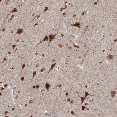 Immunohistochemistry: RFT1 Antibody [NBP2-68880] - Immunohistochemical staining of human cerebral cortex shows strong nuclear and cytoplasmic positivity in neuronal and glial cells.