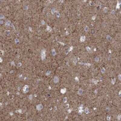 Immunohistochemistry-Paraffin RFTN2 Antibody - BSA Free