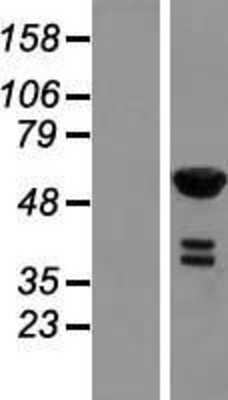 Western Blot RFTN2 Overexpression Lysate