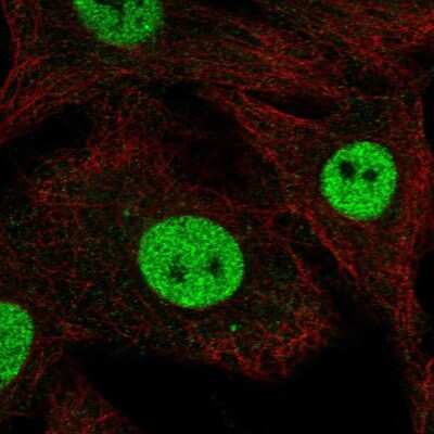 Immunocytochemistry/Immunofluorescence: RFWD3 Antibody [NBP2-58819] - Staining of human cell line A549 shows localization to nucleoplasm.