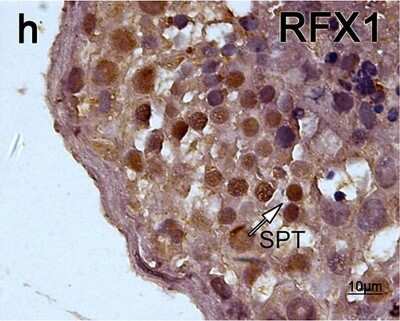 Immunohistochemistry: RFX1 Antibody [NBP1-52654] - Section stained with anti-RFX1 antibody. RFX1 belongs to Cluster 4. Spermatids were stained in brown. These distribution patterns were mostly consisted to that of trancripts. (Abbreviation: SPT=spermatid).Image collected and cropped by CiteAb from the following publication (//pubmed.ncbi.nlm.nih.gov/26753906/) licensed under a CC-BY license.