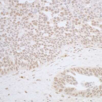 Immunohistochemistry-Paraffin RFX1 Antibody