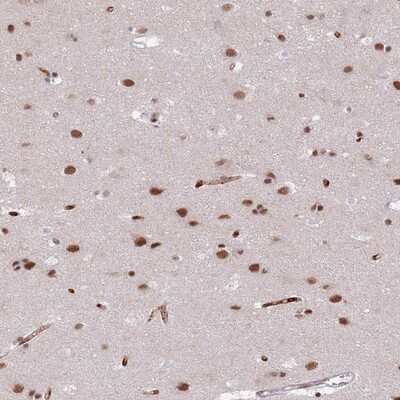 Immunohistochemistry-Paraffin RFX1 Antibody - BSA Free