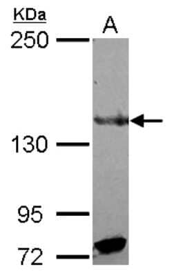 Western Blot: RFX1 Antibody [NBP2-20142] - Sample (30 ug of whole cell lysate) A: NT2D1 5% SDS PAGE gel, diluted at 1:500.