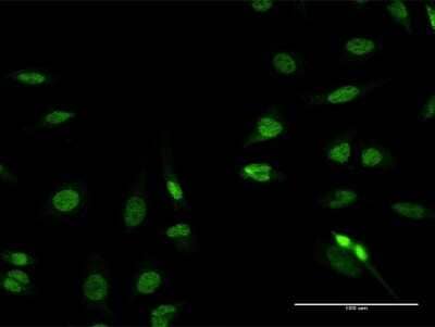 Immunocytochemistry/Immunofluorescence: RFX2 Antibody [H00005990-B01P] - Analysis of purified antibody to RFX2 on HeLa cell. (antibody concentration 10 ug/ml)