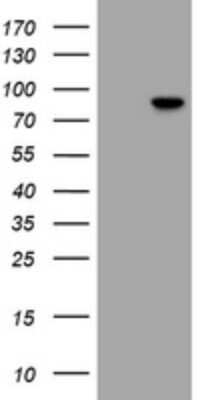 Western Blot RFX3 Antibody (OTI3F7)