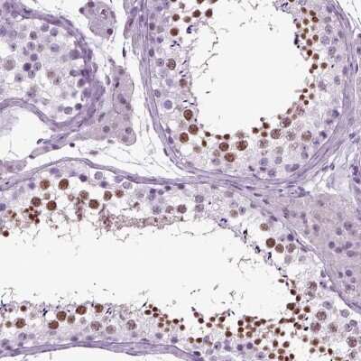 Immunohistochemistry-Paraffin: RFX3 Antibody [NBP1-86301] - Staining of human testis shows high expression.