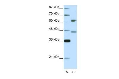 Western Blot: RFX4 Antibody [NBP2-88144] - WB Suggested Anti-RFX4 Antibody Titration: 5.0ug/ml. ELISA Titer: 1:1562500. Positive Control: 293T cell lysate