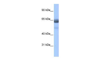 Western Blot: RFX4 Antibody [NBP2-88146] - WB Suggested Anti-RFX4 Antibody Titration: 0.2-1 ug/ml. ELISA Titer: 1:312500. Positive Control: Human Lung