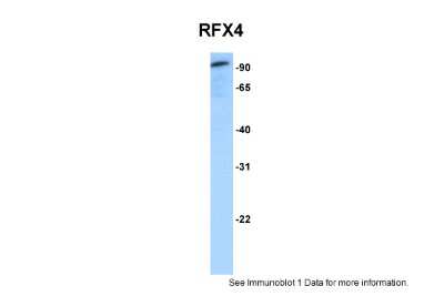 Western Blot: RFX4 Antibody [NBP2-88147] - WB Suggested Anti-RFX4 Antibody Titration: 0.2-1 ug/ml. ELISA Titer: 1:62500. Positive Control: Human brain