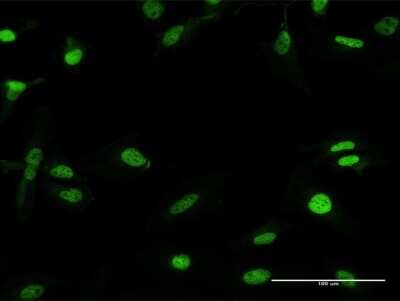 Immunocytochemistry/Immunofluorescence: RFX5 Antibody [H00005993-B01P] - Analysis of purified antibody to RFX5 on HeLa cell. (antibody concentration 10 ug/ml)