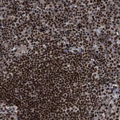 Immunohistochemistry-Paraffin: RFX5 Antibody [NBP1-86041] - Staining of human Lymph node shows strong nuclear positivity in non-germinal center and germinal center cells.