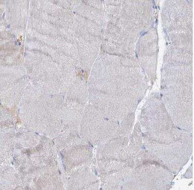 Immunohistochemistry-Paraffin RFX6 Antibody - BSA Free