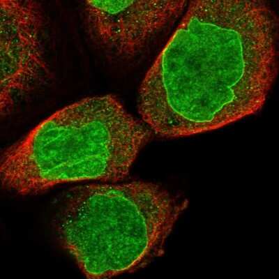 Immunocytochemistry/Immunofluorescence: RFX7 Antibody [NBP1-83705] - Staining of human cell line A-431 shows positivity in nucleus and nuclear membrane.