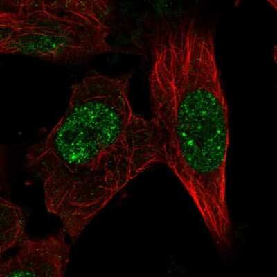 Immunocytochemistry/Immunofluorescence: RFX8 Antibody [NBP2-58601] - Staining of human cell line U-251 MG shows localization to nucleoplasm & nuclear bodies. Antibody staining is shown in green.